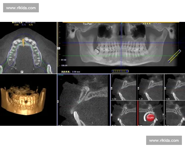 科学系统的半月板损伤康复训练与功能重建指南全面策略解析实践篇 - 副本 - 副本